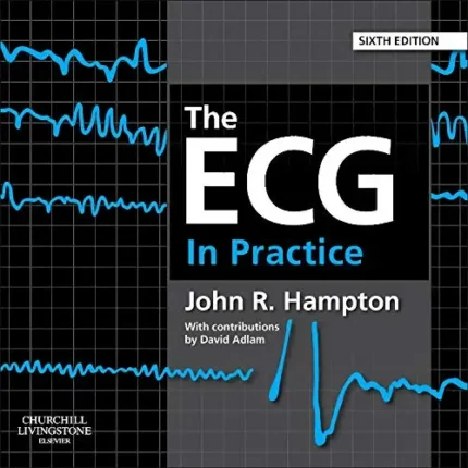 The ECG in Practice