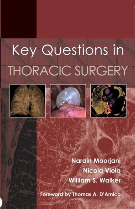 Key Questions in Thoracic Surgery 1st Edition