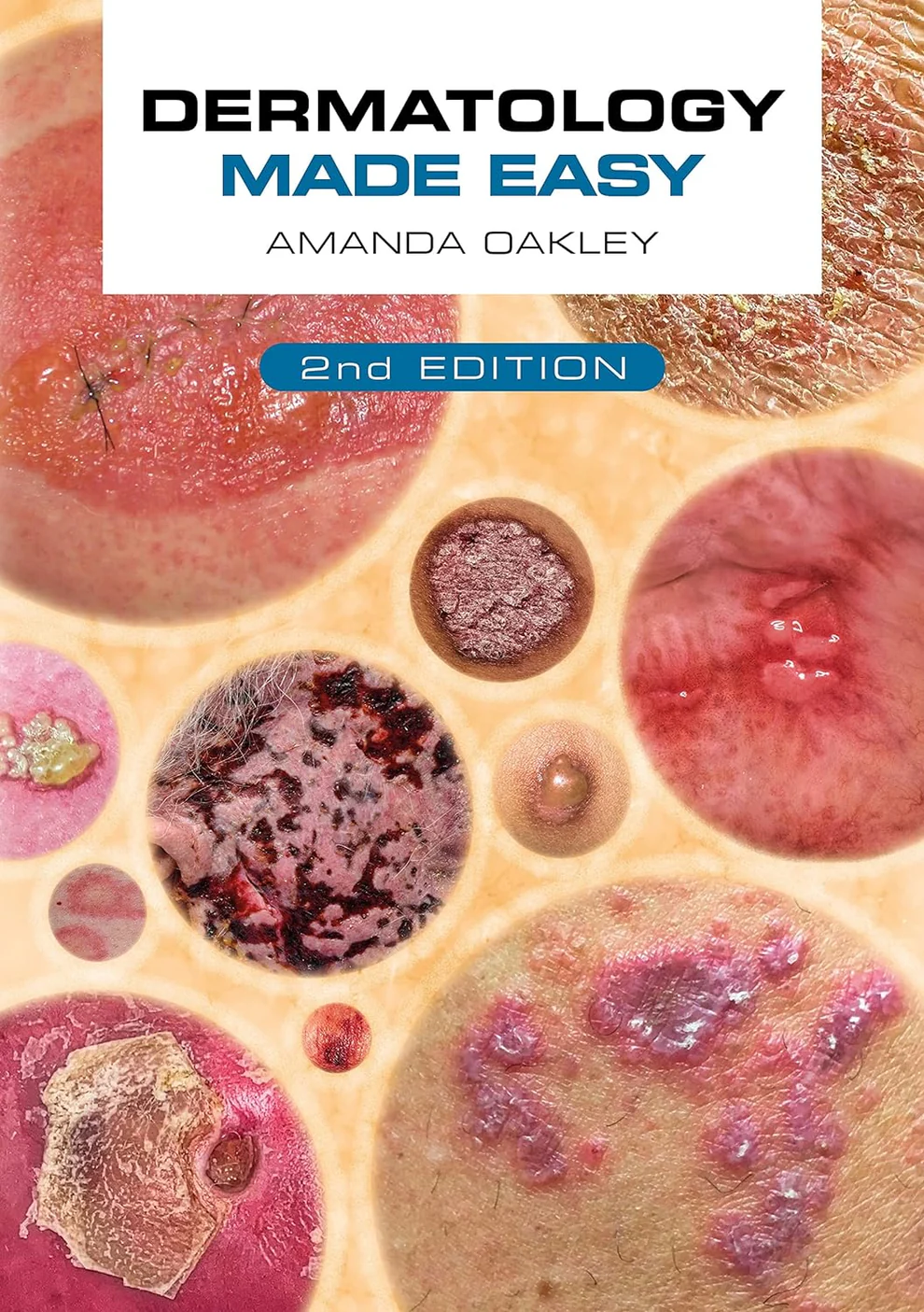 Dermatology Made Easy Second Edition Dermatology Made Easy Second Edition