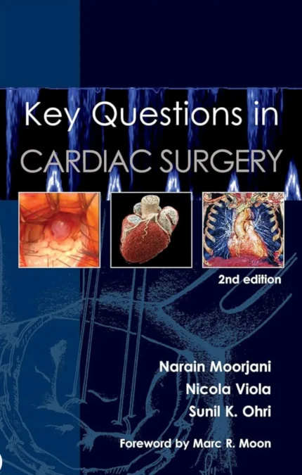 Key Questions in Cardiac Surgery 2nd Edition 2024
