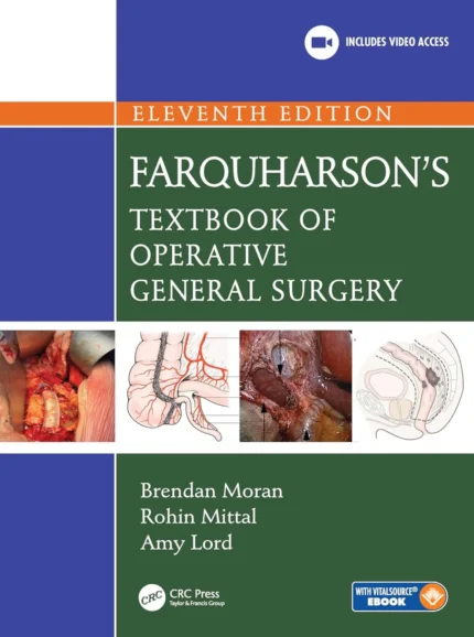 Farquharson's Operative General Surgery 11th Edition 2026 | Premium Multicolor Matte Print