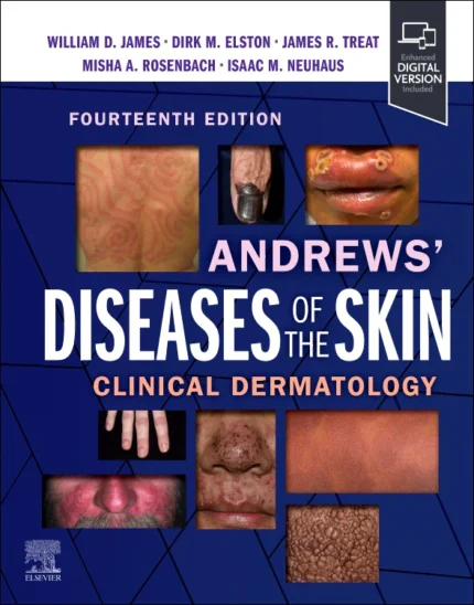 Andrews Diseases of the Skin Clinical Dermatology 14th Edition 2025