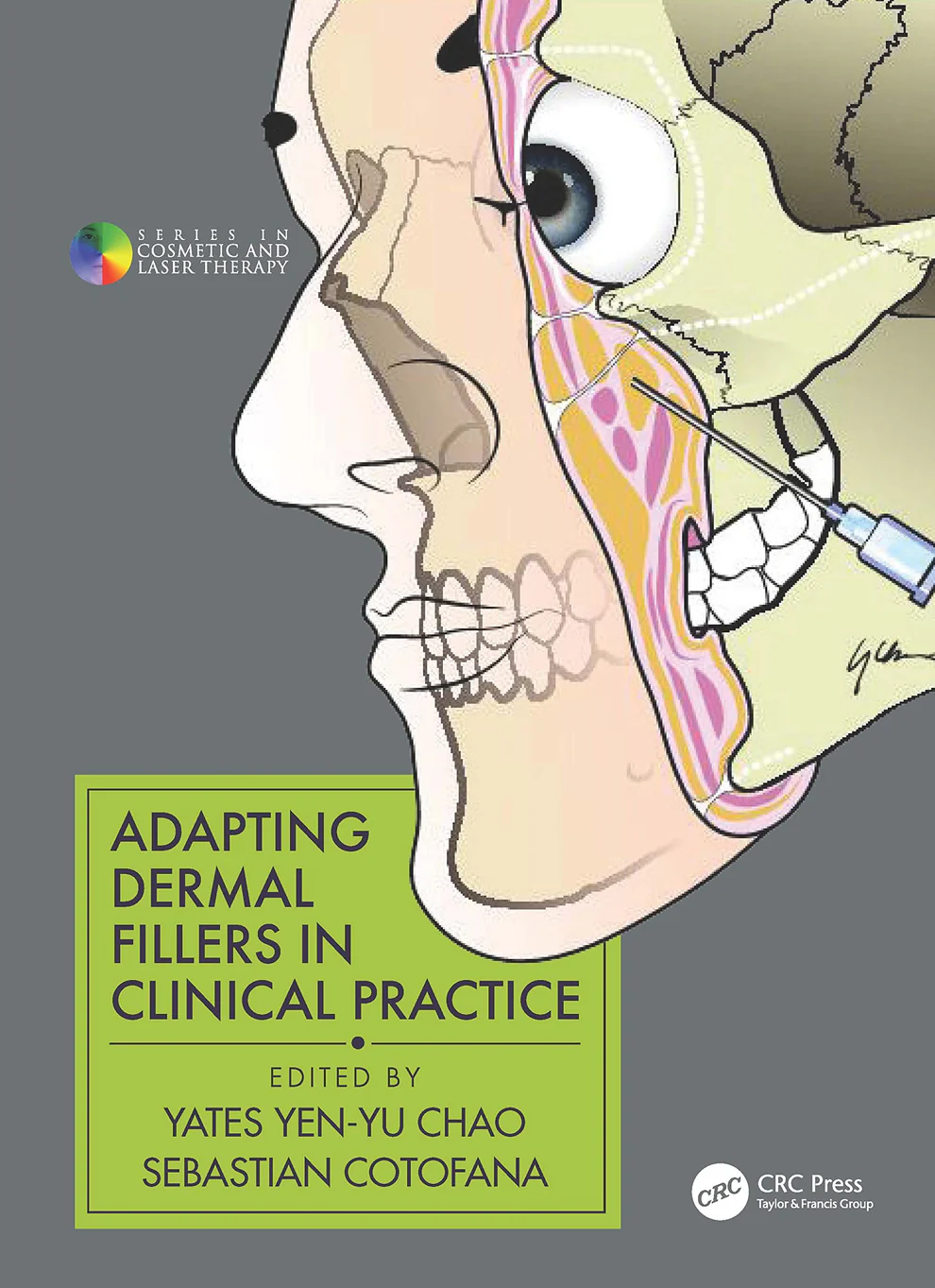 Adapting Dermal Fillers in Clinical Practice Adapting Dermal Fillers in Clinical Practice