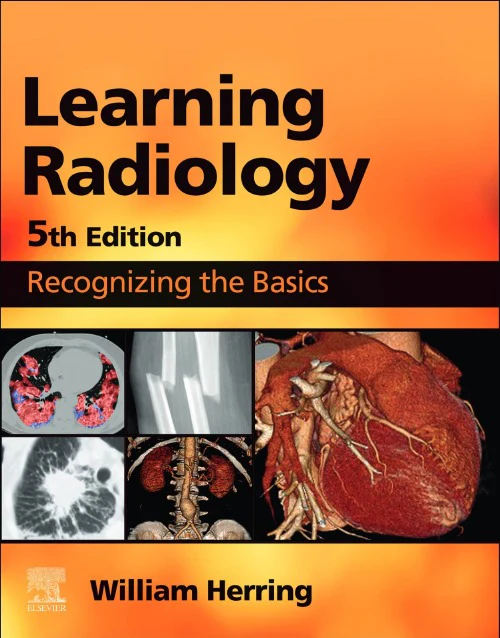 Learning Radiology: Recognizing the Basics 5th Edition Learning Radiology: Recognizing the Basics 5th Edition