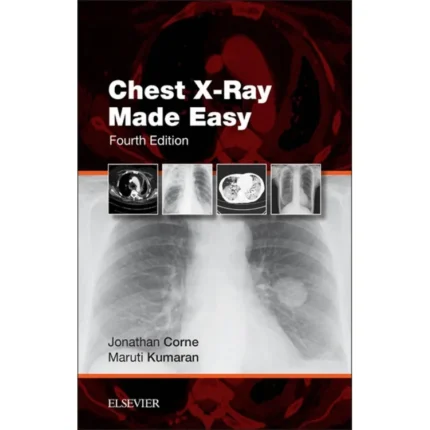 Chest X-Ray Made Easy – 4th Edition Practical Radiology Guide