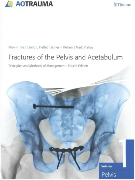 Fractures of the Pelvis and Acetabulum 4th Edition