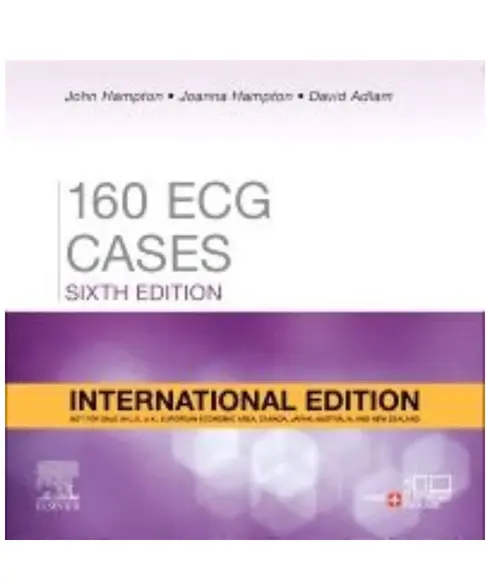 160 ECG Cases 6th Edition 2026 160 ECG Cases 6th Edition 2026