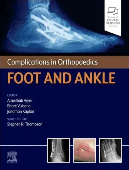 Complications in Orthopaedics: Foot and Ankle 1st Edition 2026