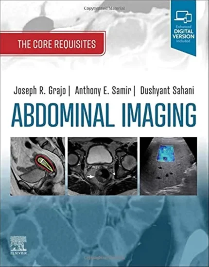 Abdominal Imaging: The Core Requisites Premium Multicolor Matte Print