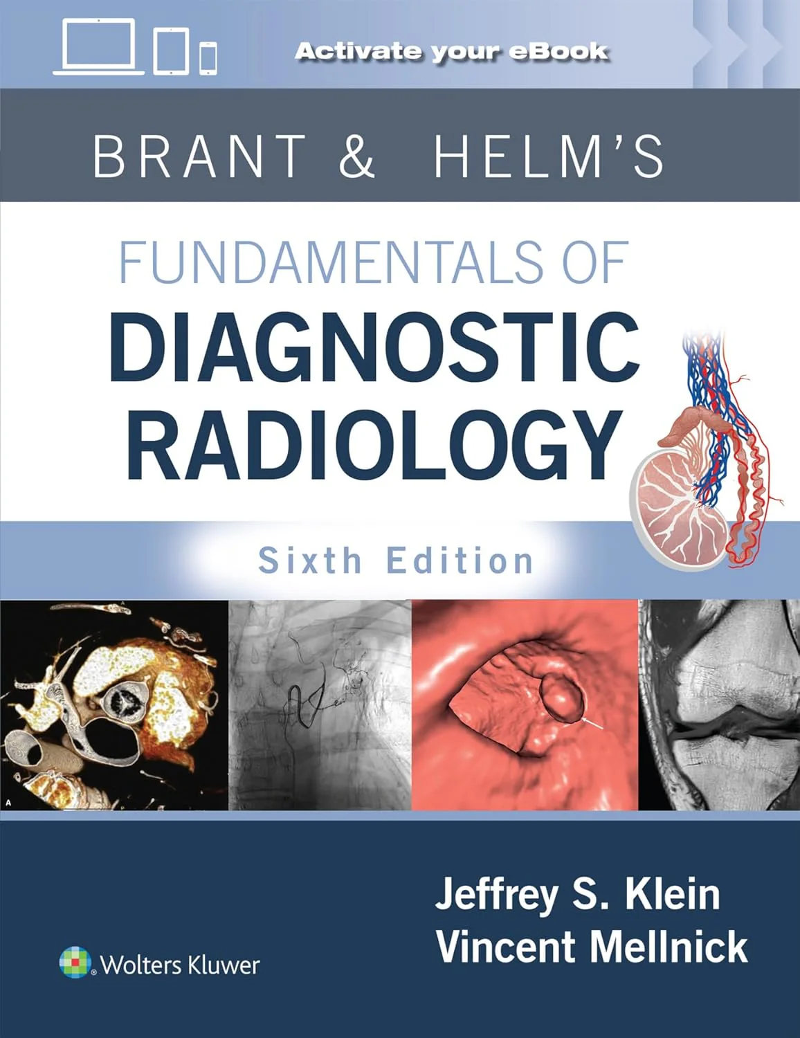 Brant & Helms' Fundamentals of Diagnostic Radiology 6th Edition | Premium Multicolor Matte Print Brant & Helms' Fundamentals of Diagnostic Radiology 6th Edition Premium Multicolor Matte Print