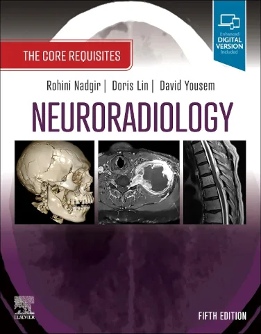Neuroradiology: The Core Requisites 5th Edition Premium Multicolor Matte Print Neuroradiology: The Core Requisites 5th Edition Premium Multicolor Matte Print