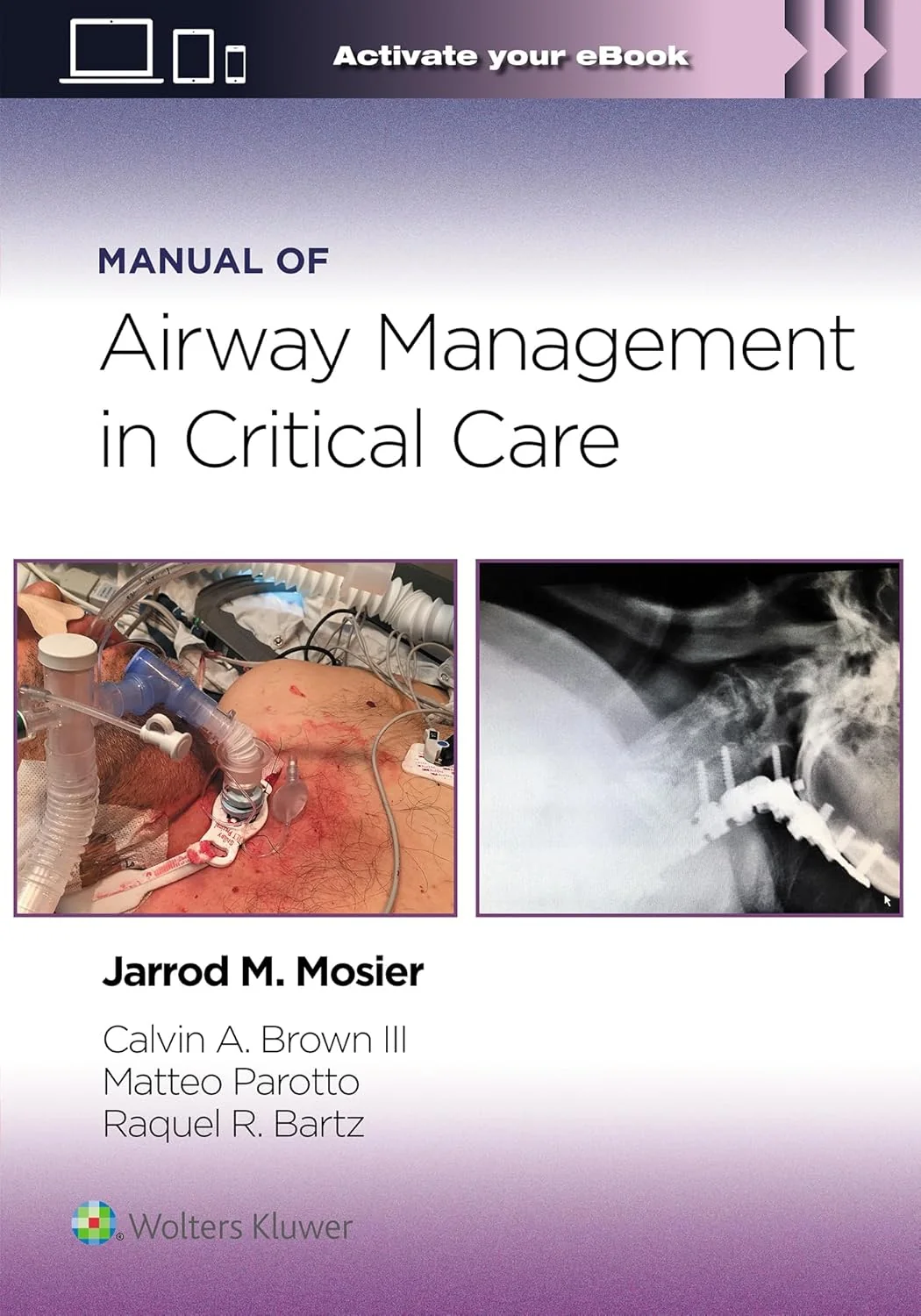Essential Manual of Airway Management in Critical Care 1st Edition Essential Manual of Airway Management in Critical Care 1st Edition