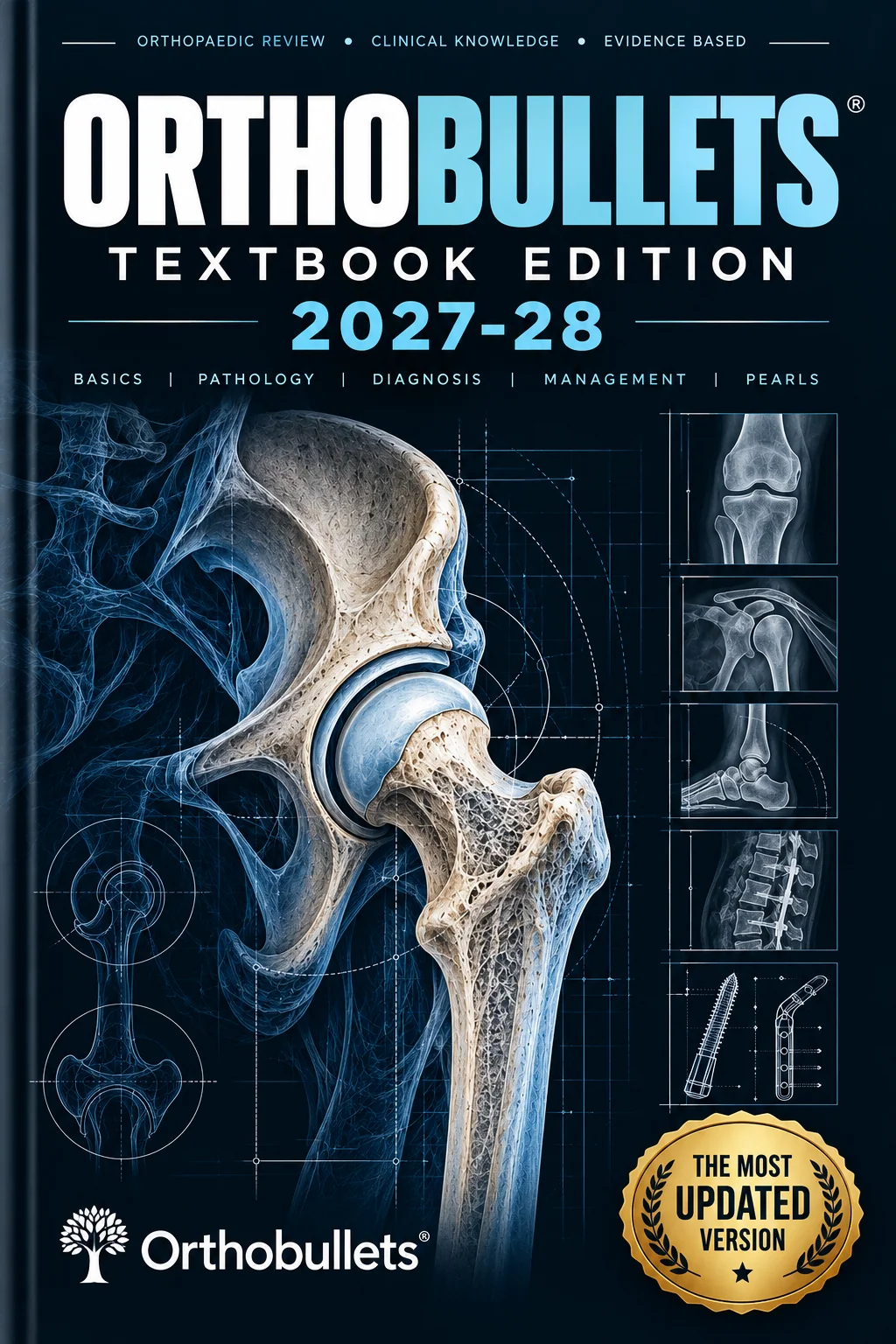 Ultimate Orthobullets Textbook 2027-28 Edition 11 Volumes Ultimate Orthobullets Textbook 2027-28 Edition 11 Volumes