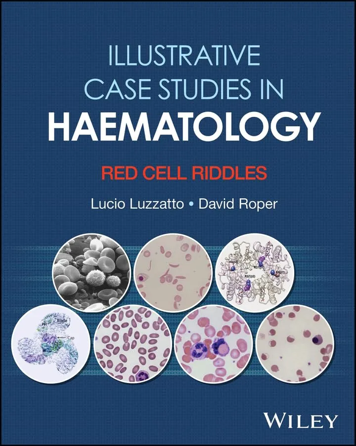 Illustrative Case Studies in Haematology: Red Cell Riddles (2026) Illustrative Case Studies in Haematology: Red Cell Riddles (2026)