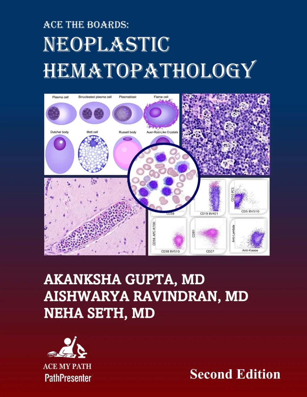 Ace The Boards: Neoplastic Hematopathology 2nd Edition Ace The Boards: Neoplastic Hematopathology 2nd Edition