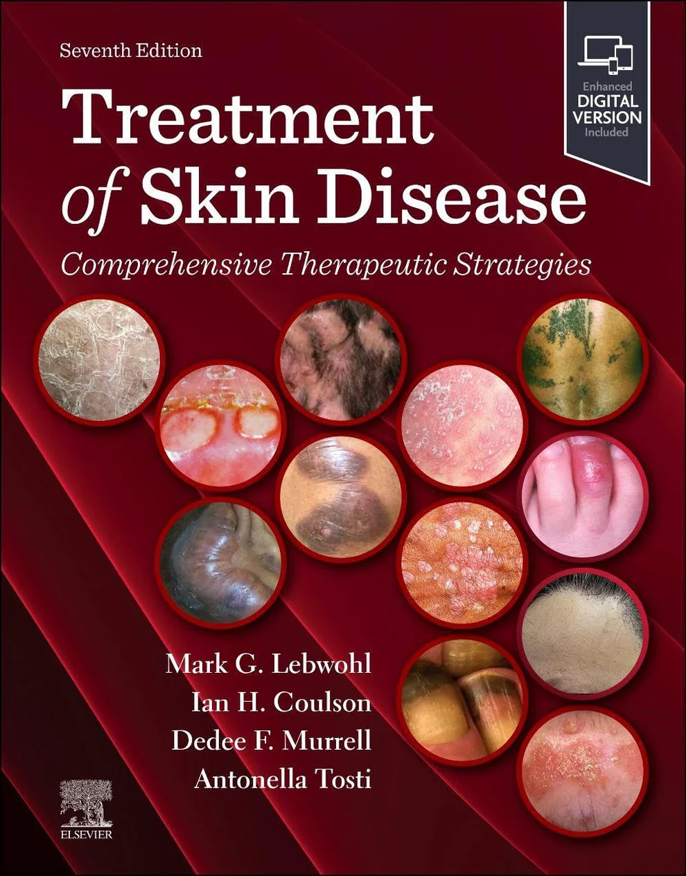 Treatment of Skin Disease: Comprehensive Therapeutic Strategies 7th Edition 2026 Treatment of Skin Disease: Comprehensive Therapeutic Strategies 7th Edition 2026